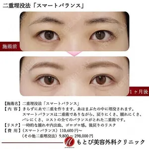 もとび美容外科クリニック 新宿院 西尾 謙三郎医師の症例