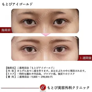 もとび美容外科クリニック 新宿院 西尾 謙三郎医師の症例