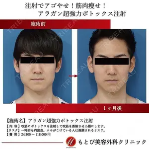 もとび美容外科クリニック 新宿院 西尾 謙三郎医師の症例