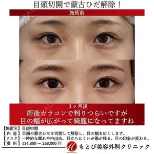 もとび美容外科クリニック 新宿院 西尾 謙三郎医師の症例