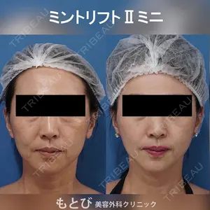 もとび美容外科クリニック 新宿院 西尾 謙三郎医師の症例