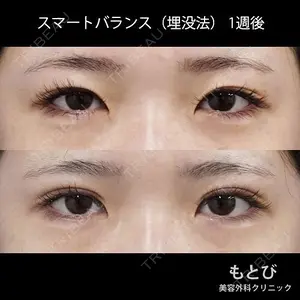 もとび美容外科クリニック 新宿院 西尾 謙三郎医師の症例