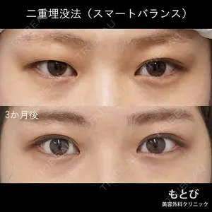 もとび美容外科クリニック 新宿院 西尾 謙三郎医師の症例