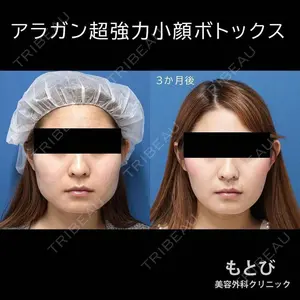 もとび美容外科クリニック 新宿院 西尾 謙三郎医師の症例