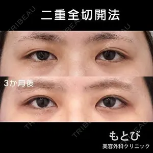 もとび美容外科クリニック 新宿院 西尾 謙三郎医師の症例