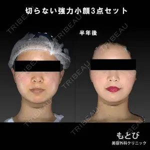 もとび美容外科クリニック 新宿院 西尾 謙三郎医師の症例
