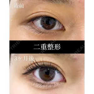 HAAB×DREAM BEAUTY CLINIC 東京本院 田中 優太医師の症例