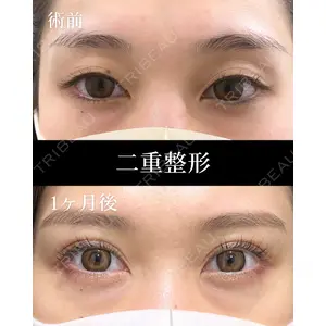 HAAB×DREAM BEAUTY CLINIC 東京本院 田中 優太医師の症例