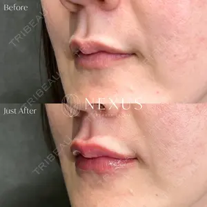 NEXUS CLINIC 渡辺　佳奈医師の症例