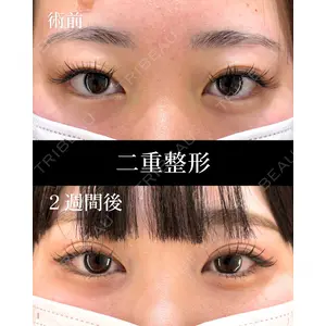 HAAB×DREAM BEAUTY CLINIC 東京本院 萩原 昂医師の症例