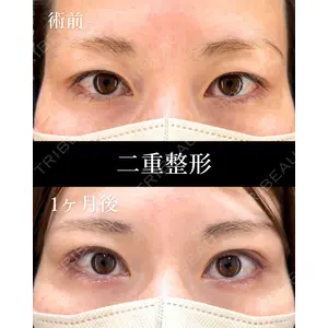 HAAB×DREAM BEAUTY CLINIC 東京本院 萩原 昂医師の症例