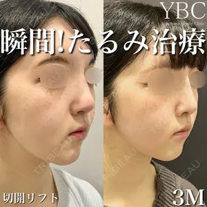 YBC横浜美容外科 大宮院 磯村 亮輔医師の症例