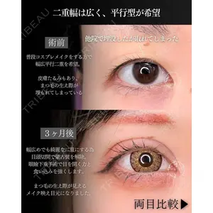 東京シンデレラ美容外科 新宿院 吉原 伯医師の症例