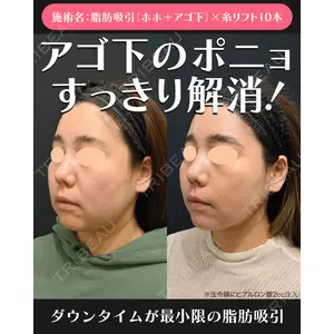 湘南美容クリニック 川崎院 伊藤 賀敏医師の症例