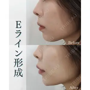 L‘amour clinic Tokyo【ラムールクリニック東京】の症例