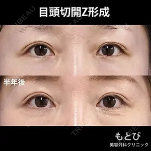 もとび美容外科クリニック 新宿院 西尾 謙三郎医師の症例