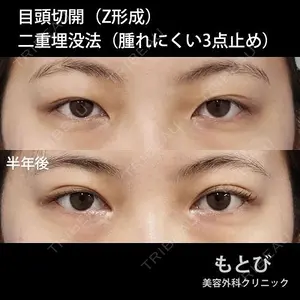 もとび美容外科クリニック 新宿院 西尾 謙三郎医師の症例