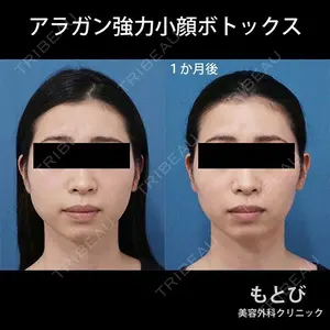 もとび美容外科クリニック 新宿院 西尾 謙三郎医師の症例