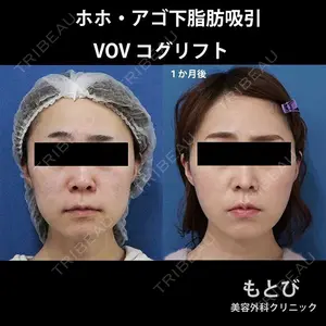 もとび美容外科クリニック 新宿院 西尾 謙三郎医師の症例
