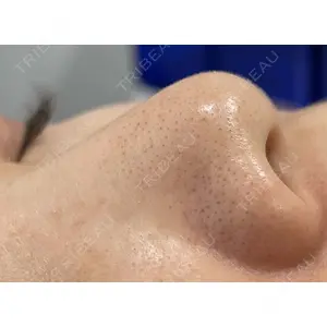 X CLINIC 恵比寿院 辻村 梢医師の症例