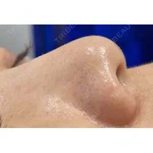 X CLINIC 恵比寿院 辻村 梢医師の症例