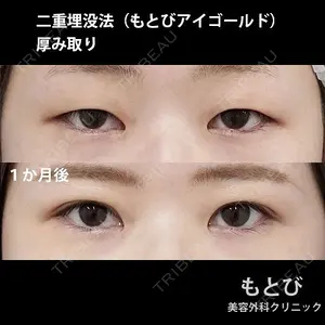 もとび美容外科クリニック 新宿院 西尾 謙三郎医師の症例