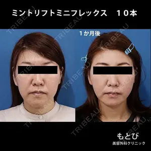 もとび美容外科クリニック 新宿院 西尾 謙三郎医師の症例