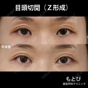 もとび美容外科クリニック 新宿院 西尾 謙三郎医師の症例