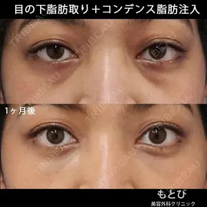 もとび美容外科クリニック 新宿院 西尾 謙三郎医師の症例
