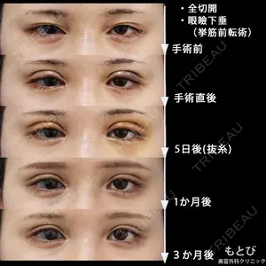 もとび美容外科クリニック 新宿院 西尾 謙三郎医師の症例
