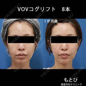 もとび美容外科クリニック 新宿院 西尾 謙三郎医師の症例