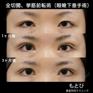 もとび美容外科クリニック 新宿院 西尾 謙三郎医師の症例