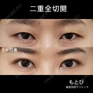もとび美容外科クリニック 新宿院 西尾 謙三郎医師の症例