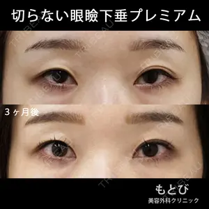 もとび美容外科クリニック 新宿院 西尾 謙三郎医師の症例