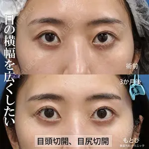 もとび美容外科クリニック 新宿院 西尾 謙三郎医師の症例
