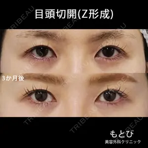 もとび美容外科クリニック 新宿院 西尾 謙三郎医師の症例