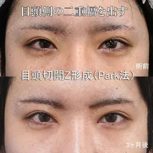 もとび美容外科クリニック 新宿院 西尾 謙三郎医師の症例