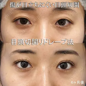 もとび美容外科クリニック 新宿院 西尾 謙三郎医師の症例