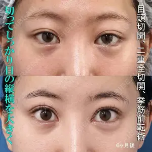 もとび美容外科クリニック 新宿院 西尾 謙三郎医師の症例