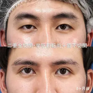 もとび美容外科クリニック 新宿院 西尾 謙三郎医師の症例