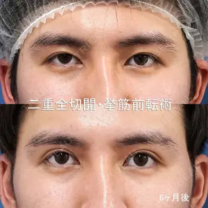もとび美容外科クリニック 新宿院 西尾 謙三郎医師の症例