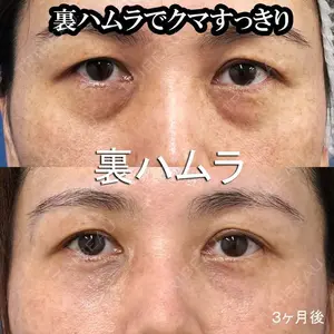 もとび美容外科クリニック 新宿院 西尾 謙三郎医師の症例