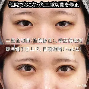 もとび美容外科クリニック 新宿院 西尾 謙三郎医師の症例