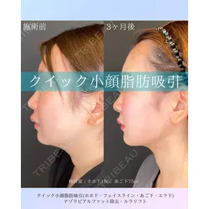 ルラ美容クリニック 札幌院 佐藤 雄紀医師の症例
