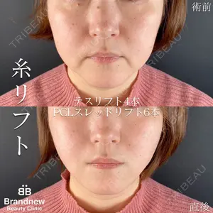 Brandnew Beauty Clinic 平山 容成医師の症例