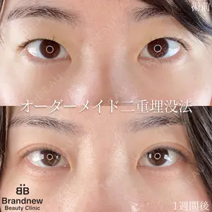Brandnew Beauty Clinicの症例