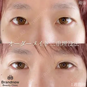 Brandnew Beauty Clinicの症例