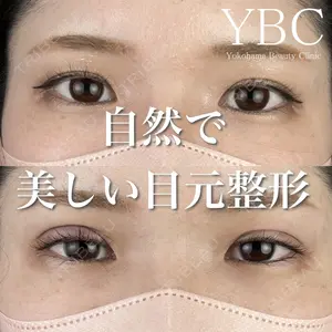 YBC横浜美容外科 大宮院 磯村 亮輔医師の症例
