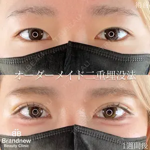 Brandnew Beauty Clinicの症例