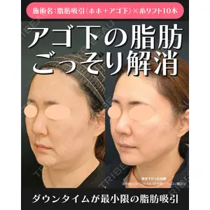 湘南美容クリニック 川崎院 伊藤 賀敏医師の症例